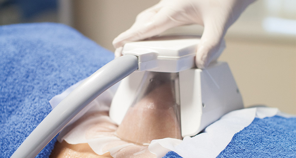 How Fat Freezing and HIFU Work Together? 2 Multiple Areas in One Session HIFU and Fat Freezing Slough